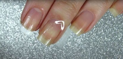Felismered a gombás körmöt? - Perfect Nails BLOG
