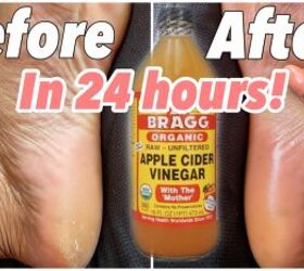 How to Get Dead Skin Off Feet & Make Them Feel Soft Again in 24 Hours