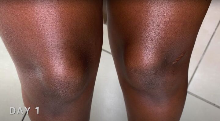 how to make an effective dark knees remedy with natural ingredients, How to lighten dark knees