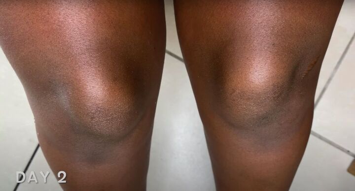 how to make an effective dark knees remedy with natural ingredients, Fighting pigmentation with a home remedy