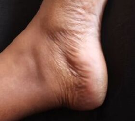 DIY Listerine Dead Skin Remover Foot Soak - STOCKPILING MOMS™