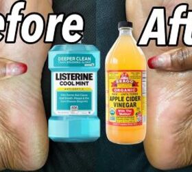 Listerine & Vinegar Foot Soak For Dead Skin - Does It Work?