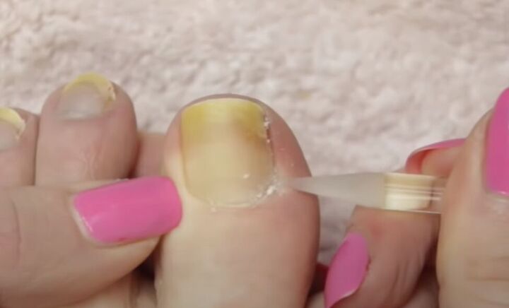 how to give yourself an amazing toenail makeover at home, Removing cuticles with a cuticle stick