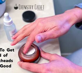 how to get rid of blackheads for good