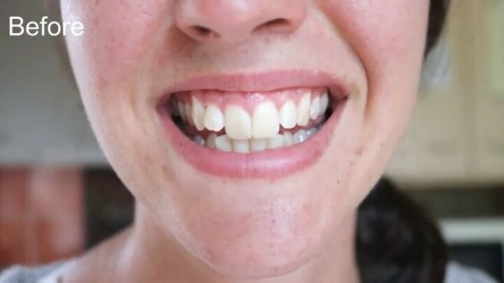 3 quick and easy steps to whiten your teeth naturally, Teeth whitening before