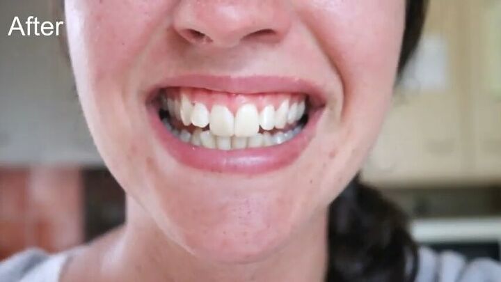 3 quick and easy steps to whiten your teeth naturally, Teeth whitening after