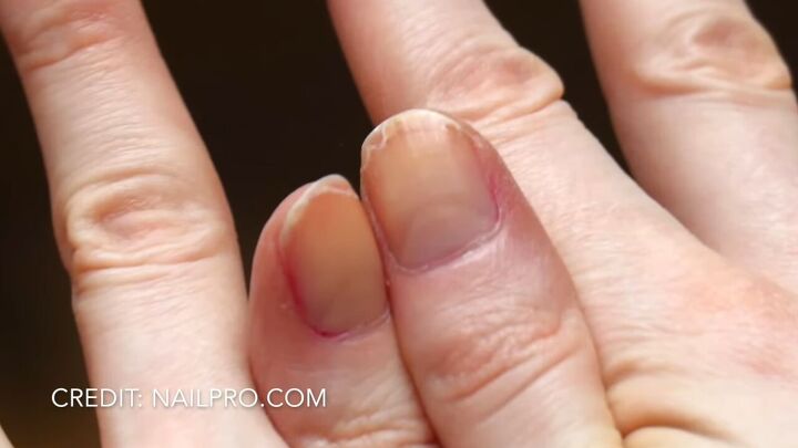 how to naturally strengthen nails, Peeling nails