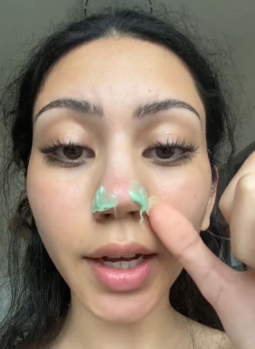 how to get rid of the black dots on your nose, Wax applied to nose