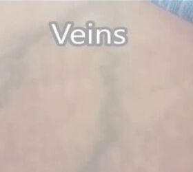 Why women are checking their veins in sunlight