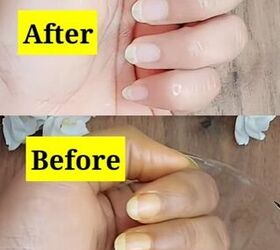 Do This to Turn Your Yellow Nails White
