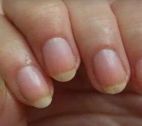 acrygel nails, Nails after acrygel removal