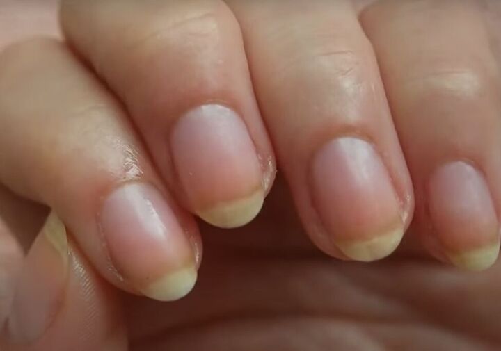 acrygel nails, Nails after acrygel removal