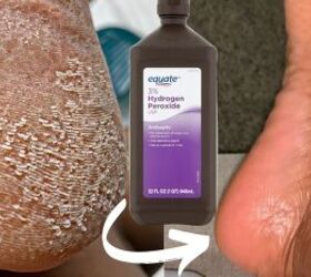 Try Adding Hydrogen Peroxide to Your Feet