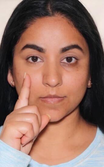 Easy Concealer Hack for Covering Acne Scars | Upstyle