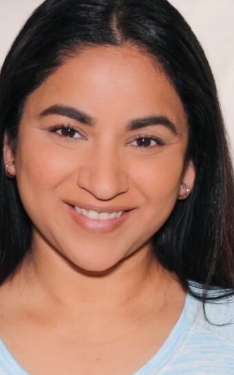 Easy Concealer Hack for Covering Acne Scars | Upstyle