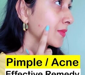pimple spot treatment with 2 ingredients in your kitchen, Pimple