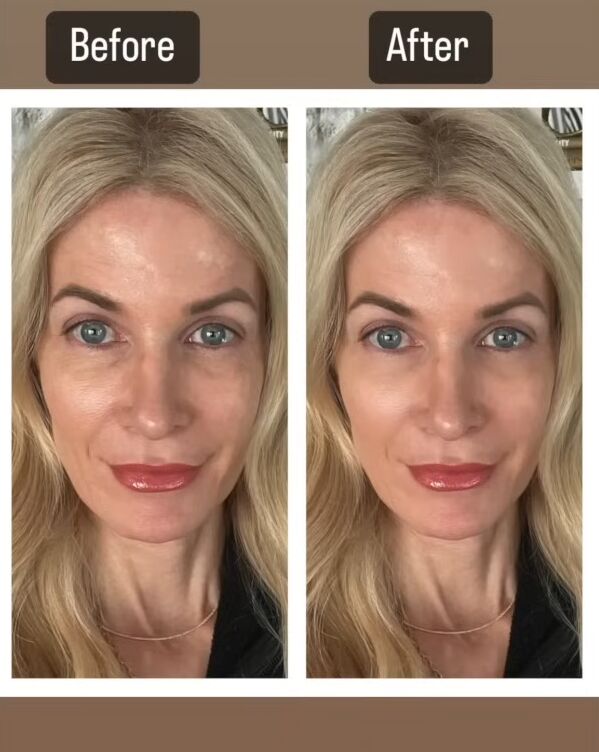 beauty tips for women over 40, Zip Halo before and after results