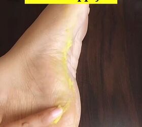 If your heels crack in winter, this little fix helps