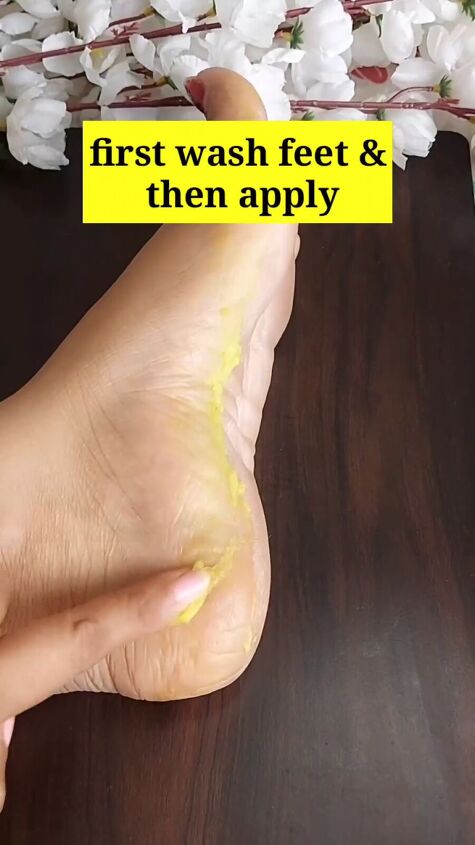 how a candle can help cure your cracked heels, Applying to feet