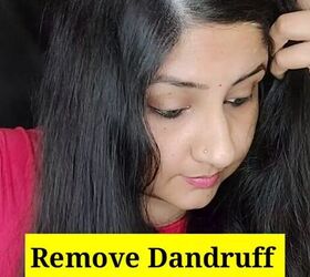 powerful diy serum to get rid of dandruff, Dandruff on scalp