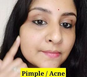 Remove Acne and Blemishes With This Easy Recipe