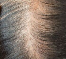 Is Your Hair Thinning? Here Are 3 Amazing Products to Try