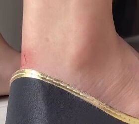 How to stop shoe blisters​