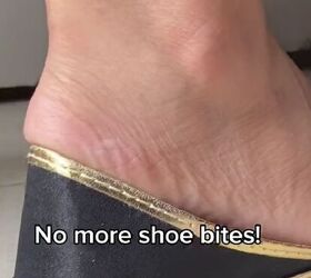 How to stop shoe blisters​