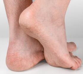 Stop neglecting your feet this winter and winter-proof them with these brilliant ideas