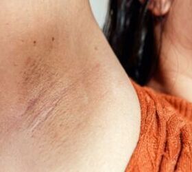 Why women are swiping glycolic acid under their arms at night