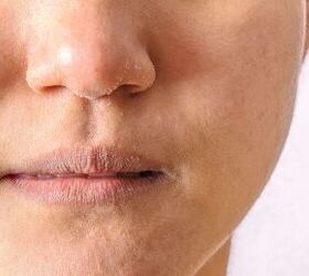 Dry, flaky lips don’t have to be your winter “thing”