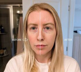 Tips For Reducing Redness Without Makeup | Upstyle