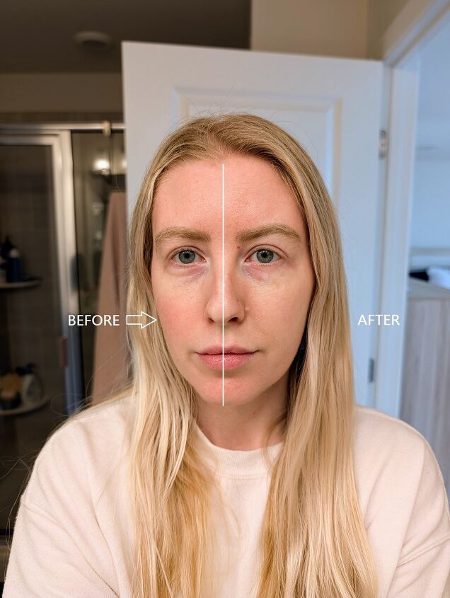 Tips For Reducing Redness Without Makeup | Upstyle