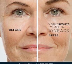 These products can help brighten dark circles and tired under-eyes