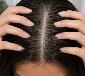 Oily scalp