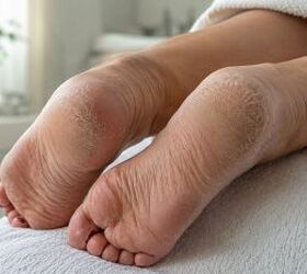 These foot-care favorites are everywhere this summer